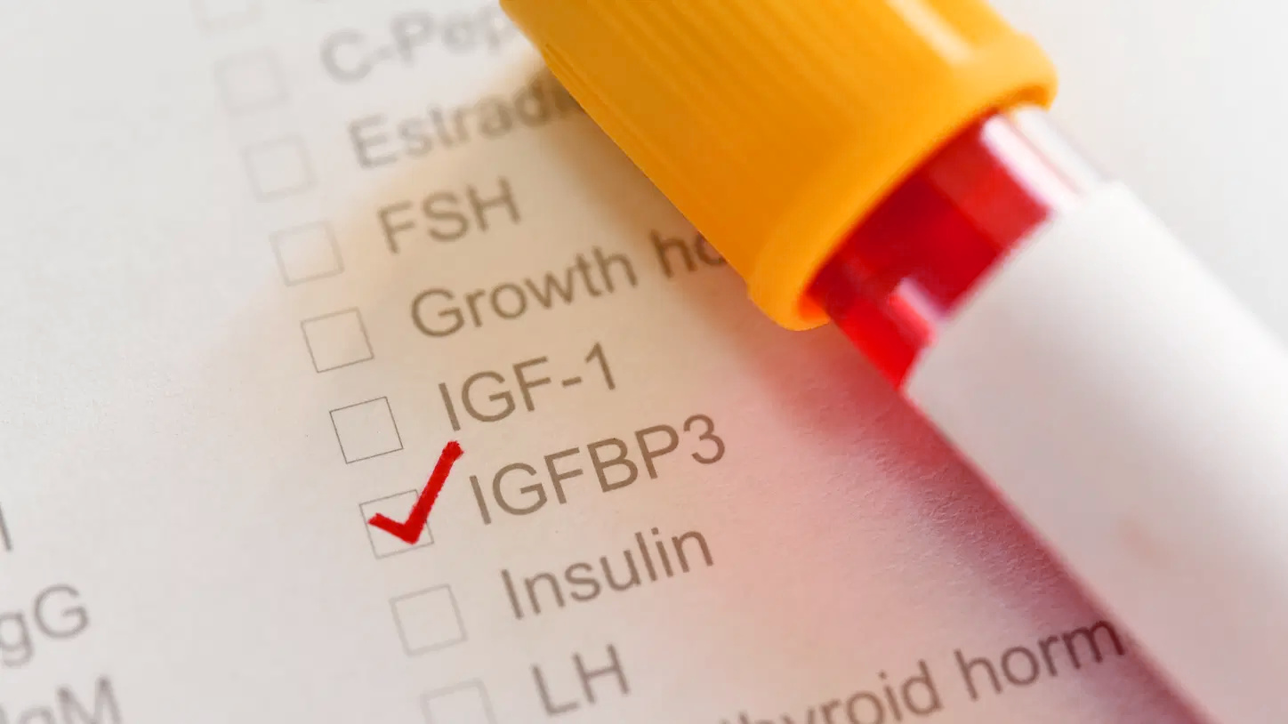 IGF-1 (Insulin-like Growth Factor 1)